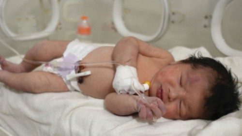 EDITORS NOTE: Graphic content / TOPSHOT - A newborn baby who was found still tied by her umbilical ...
