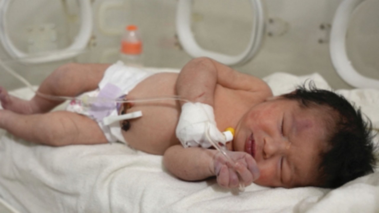EDITORS NOTE: Graphic content / TOPSHOT - A newborn baby who was found still tied by her umbilical ...