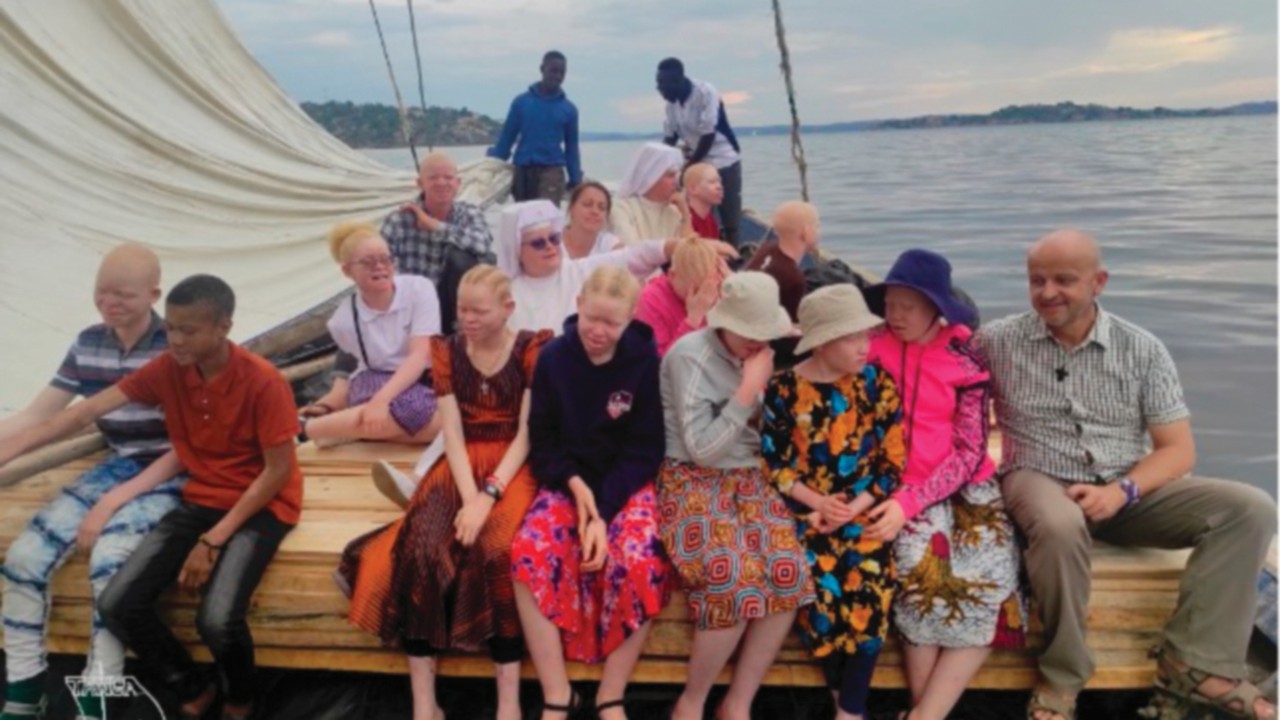   Tanzania: una casa para niños albinos  que cambia su vida  SPA-040