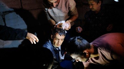 epaselect epa08721046 An injured man receives a medical treatment after shelling by Azerbaijani ...