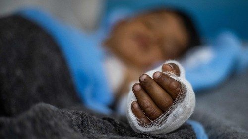 Un bambino ferito da un’esplosione in Siria (Afp)