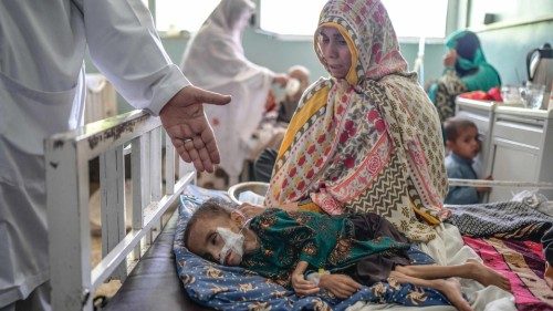 A child suffering from malnutrition receives treatment at the Mirwais hospital in Kandahar on ...