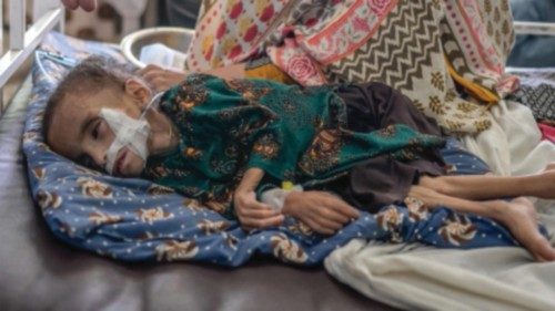 A child suffering from malnutrition receives treatment at the Mirwais hospital in Kandahar on ...