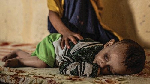 Sfollati a Marib in Yemen, in una foto diffusa l'8 febbraio 2022. ANSA/ UFFICIO STAMPA OXFAM ++HO - ...