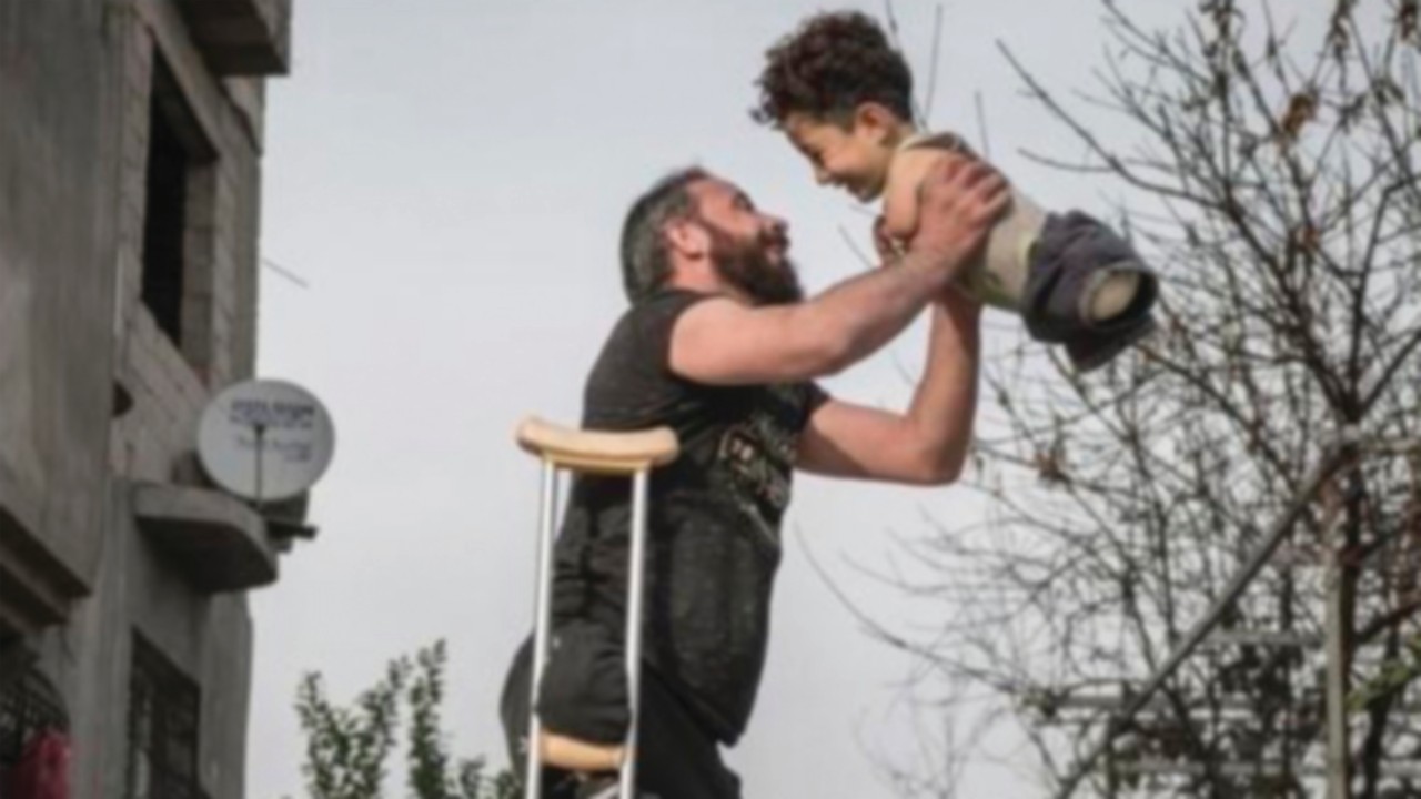 Un bambino siriano di 5 anni, nato senza braccia e gambe, immortalato sorridente con il padre, ...