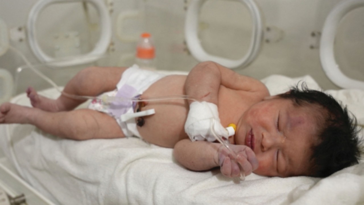 EDITORS NOTE: Graphic content / TOPSHOT - A newborn baby who was found still tied by her umbilical ...
