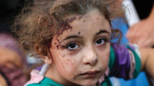 Children who were injured during an Israeli operation in the Jabalia refugee camp in the central ... Children who were injured during an Israeli operation in the Jabalia refugee camp in the central ...
