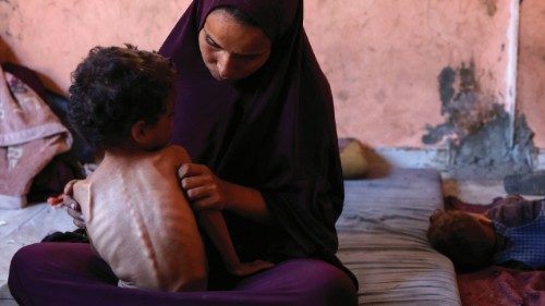 Naeema, a 30-year-old Palestinian mother, sits with her malnourished 2-year-old son Yazan in their ... Naeema, a 30-year-old Palestinian mother, sits with her malnourished 2-year-old son Yazan in their ...