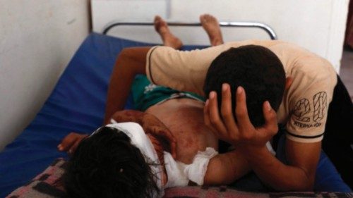 A young boy sits near am injured child at a hospital, following an explosion in Maarrat Misrin in ... A young boy sits near am injured child at a hospital, following an explosion in Maarrat Misrin in ...