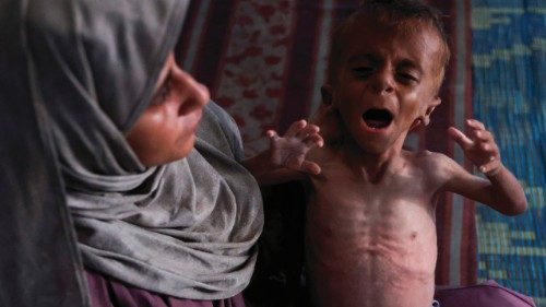 Hidaya, a 31-year-old Palestinian mother, cradles her sick 18-months old son Mohammed al-Mutawaq, ... Hidaya, a 31-year-old Palestinian mother, cradles her sick 18-months old son Mohammed al-Mutawaq, ...