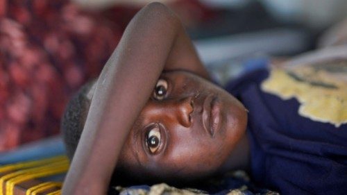 A Sudanese cholera patient looks on as he lies on a bed at a United Nations-Run makeshift clinic, in ...